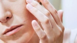 Managing Eczema Flare-Ups: Tips for Itchy, Dry Skin